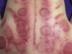 -扶阳灸推拿养生馆
