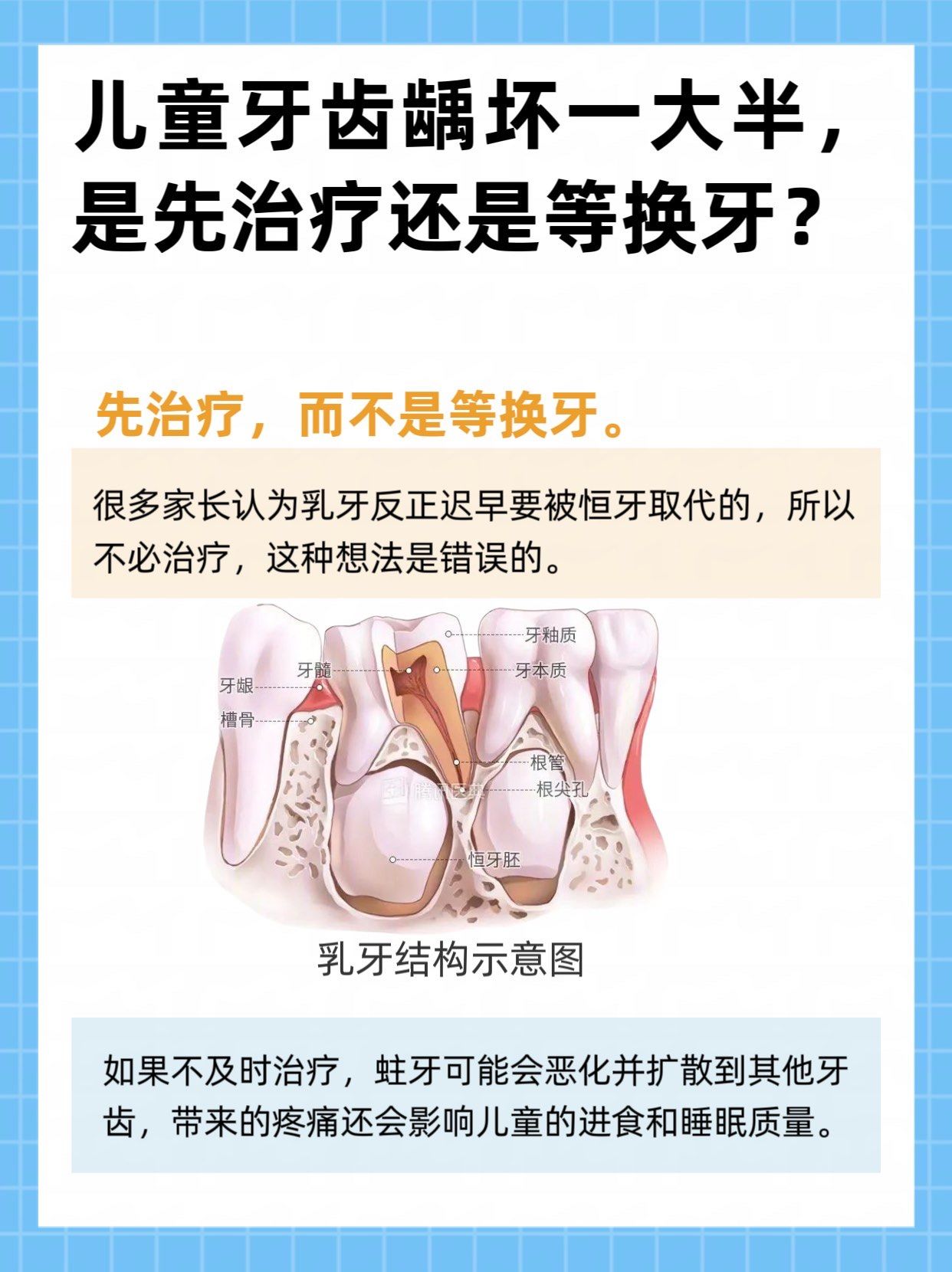 儿童牙齿龋坏一大半是先治疗还是等换牙?