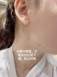 体验后-Yestar艺星医疗美容医院