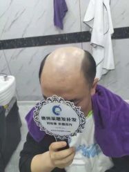 -唐风采假发补发定制