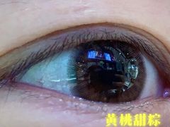 -宝岛眼镜(北京亚运村旗舰店)