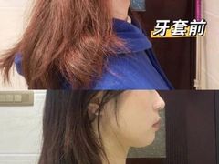 -极光口腔·矫正种植修复(锦江店)