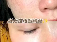 -上海皮肤专科医院