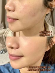 -LUNA皮相美·骨相美高级美感