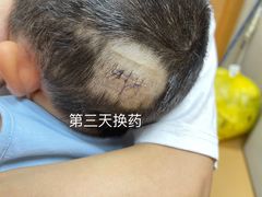 -广州市第一人民医院(院本部)