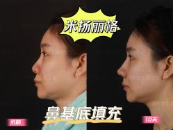 -北京米扬丽格医疗美容·联合丽格鼻整形中心