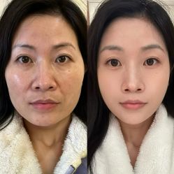 -Yestar 嘉兴艺星医疗美容医院
