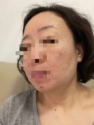 -荟草堂专业痘肌皮肤管理