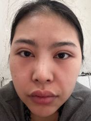 -杭州美莱医疗美容医院