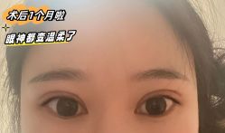 -素美医疗美容·西南眼鼻整形·修复基地