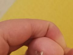 -新甲连锁灰指甲·甲沟炎·鸡眼(黑龙江路店)