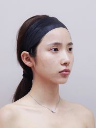 -深圳艺星医疗美容医院