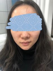 -元熙兰积皮肤管理