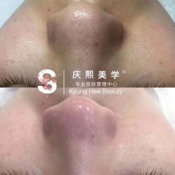 -S庆熙美学皮肤管理