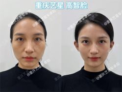 -Yestar重庆艺星医疗美容医院