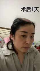 -雍禾植发全国连锁