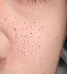 -韩国淼美颜皮肤管理官方直营店