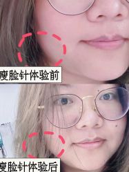 -弘美医美·艾维岚童颜抗衰中心
