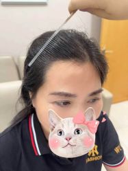 -大麦微针植发丨全国连锁