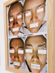 -美肤盾祛痘·问题肌头疗管理中心