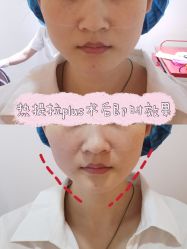 -天津伊美尔医疗整形美容专科医院