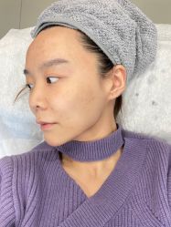 体验后-加减美医美连锁品牌