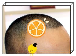 -大麦微针植发全国连锁