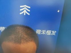 -雍禾植发全国连锁