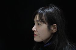 -洁铭新加坡医美
