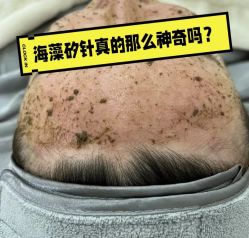 -VE专注问题肌·赛诺龙&科学美肤中心