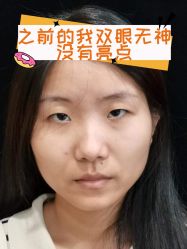-素美医疗美容·西南眼鼻整形·修复基地