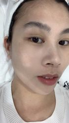 体验前-慕颜医疗美容·皮肤微整 抗衰