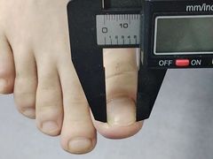 -祖传修脚甲沟炎灰指甲鸡眼