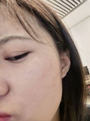 体验后-深圳医恒美医疗美容