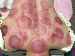 -沈师傅盲人按摩工作室(密三小区店)