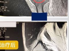 -申驰运动康复中心·中立位肌肉加强馆