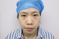 -天津健丽·去眼袋医疗美容机构