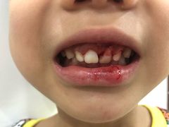 -Dr.Z dental仁康种植矫正中心