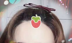 -大麦微针植发全国连锁