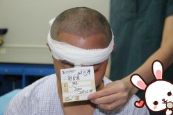 点击看大图 -大麦微针植发丨全国连锁