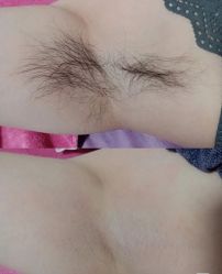 -薇兰专业脱毛连锁机构