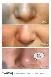 脸部抗衰-光SPA科技美肤