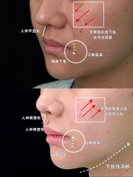 点击看大图 -欧兔博士·O2BOX微高压氧舱