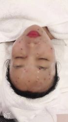 -OAE日式皮肤管理お肌の