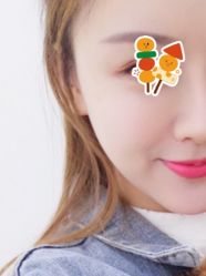 体验前-美莱医疗美容医院