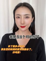 -雍禾植发全国连锁