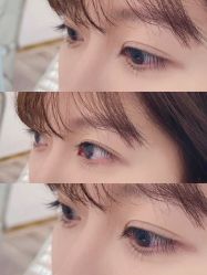 -宥莉·ULLY 痘敏肌•科技皮肤管理中心