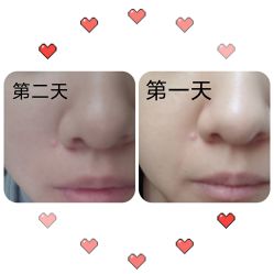 体验前-北京米扬丽格医疗美容·联合丽格鼻整形中心
