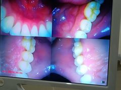 -土豆口腔(凤凰北总店)