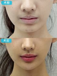 -深圳艺星医疗美容医院